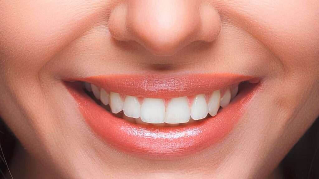 Home rimedi per lo sbiancamento dei denti