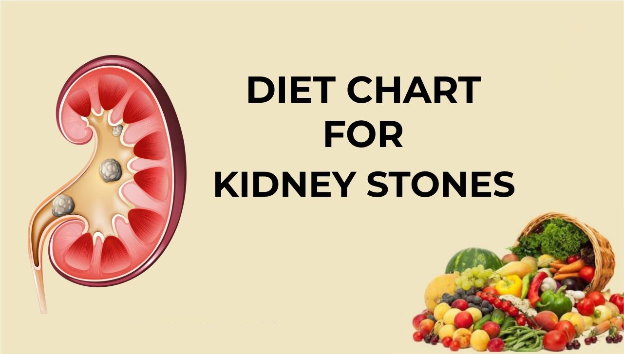 Kidney Stone Diet Plan and Prevention