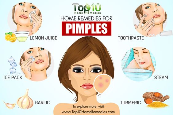 10 Home Remedies To Get Rid of Pimples – FitOlympia